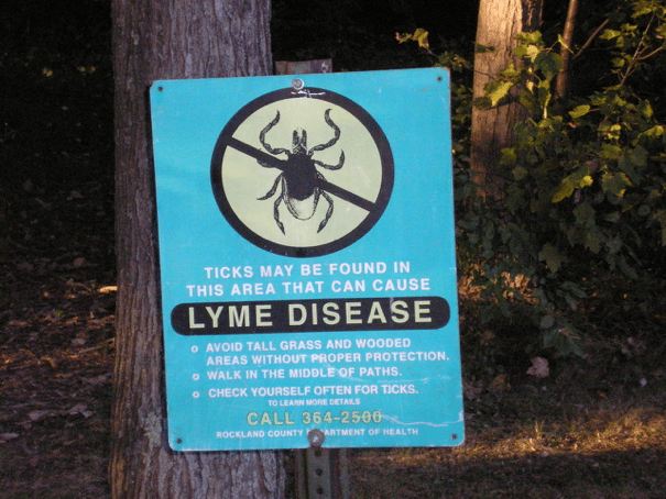 lyme disease